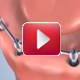   VIDEO |  Dentier sur implants dentaires  